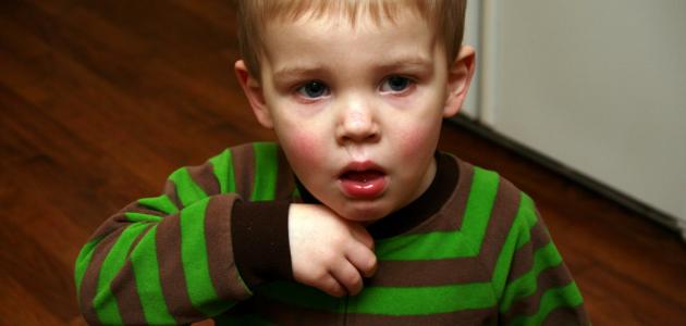 التهاب القصبات الحاد التهاب القصبات الحاد