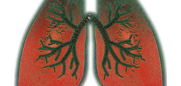 التهاب القصبات المزمن التهاب القصبات المزمن