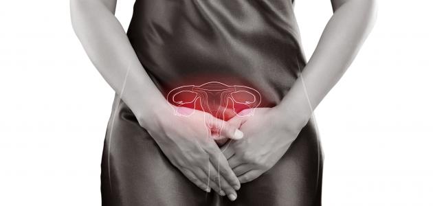 التهاب بكتيري في المهبل التهاب بكتيري في المهبل