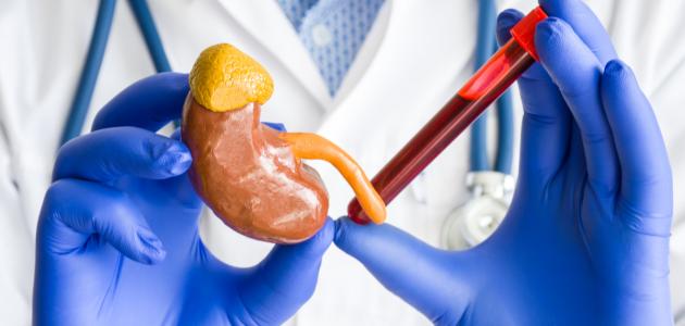 التهاب في الكلى التهاب في الكلى