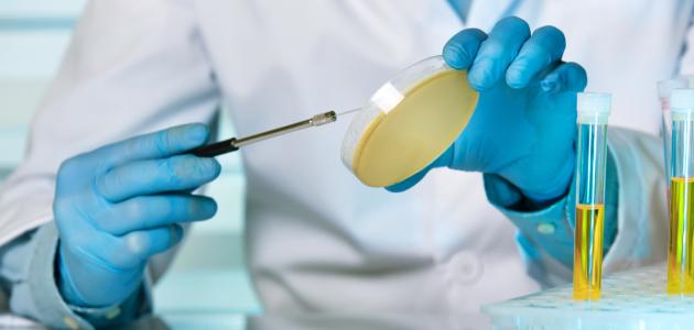 التهاب في مجرى البول التهاب في مجرى البول