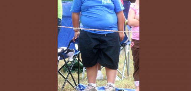 السمنة الزائدة عند الأطفال