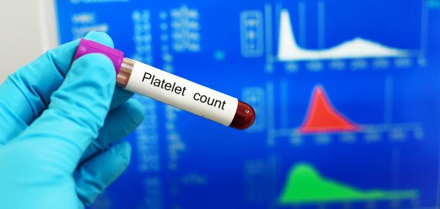 العدد الطبيعي للصفائح الدموية العدد الطبيعي للصفائح الدموية