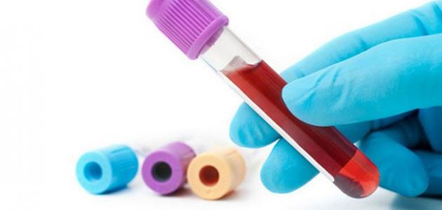 الفحوصات المخبرية لنقص الكوليسترول