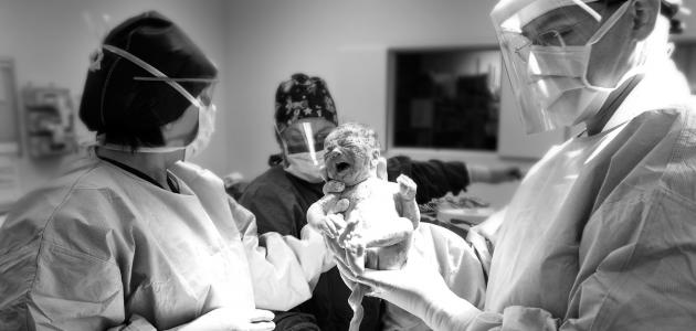 الولادة القيصرية الولادة القيصرية