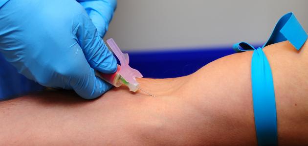 تحليل الأمونيا تحليل الأمونيا