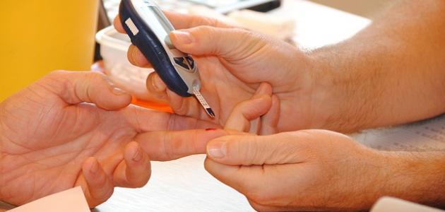 تحليل السكر