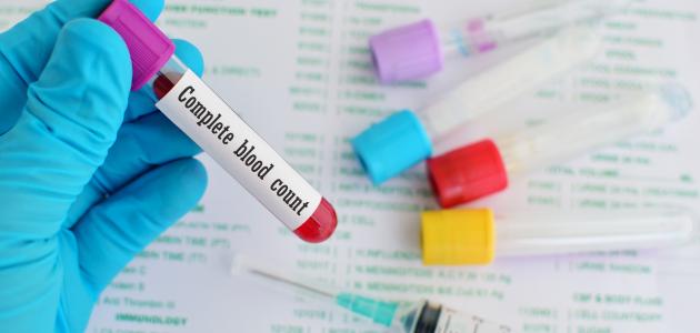 تحليل دهون الكبد تحليل دهون الكبد