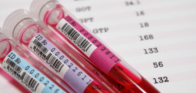 تحليل سرعة الترسيب تحليل سرعة الترسيب