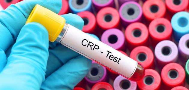 تحليل مقاومة الإنسولين