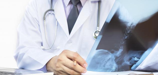 تحليل هشاشة العظام تحليل هشاشة العظام