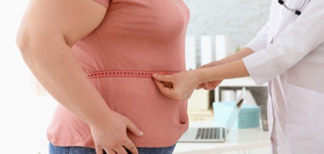 تعريف السمنة تعريف السمنة