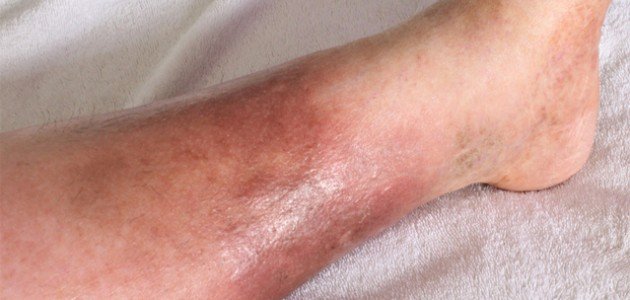 تعريف النسيج الخلوي