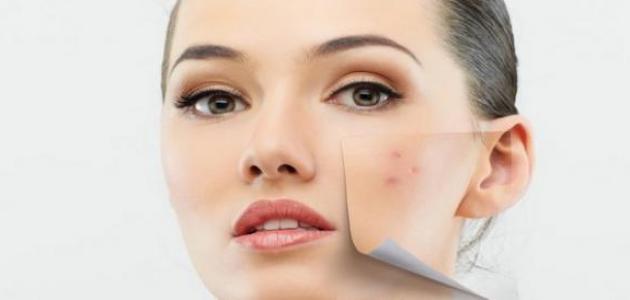 تقشير الوجه لإزالة آثار الحبوب تقشير الوجه لإزالة آثار الحبوب