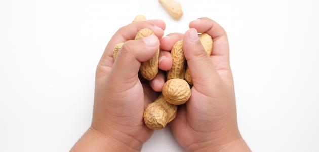 حساسية الطعام عند الأطفال حساسية الطعام عند الأطفال