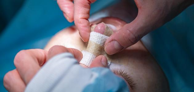 حكم عمليات التجميل حكم عمليات التجميل