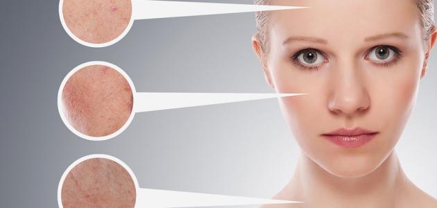 حل للبشرة الدهنية