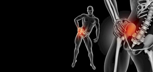 خشونة مفصل الورك خشونة مفصل الورك