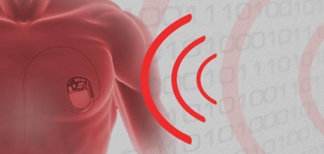 زيادة كهرباء القلب زيادة كهرباء القلب