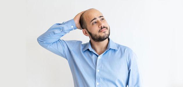 شعر خفيف في مقدمة الرأس شعر خفيف في مقدمة الرأس