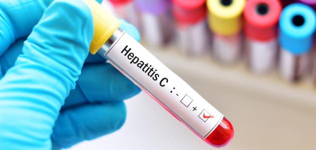 طرق انتقال عدوى فيروس C