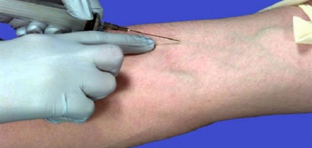 طريقة سحب الدم طريقة سحب الدم