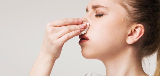 طريقة وقف نزيف الأنف طريقة وقف نزيف الأنف