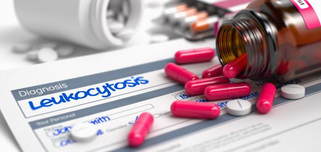 علاج ارتفاع كريات الدم البيضاء علاج ارتفاع كريات الدم البيضاء