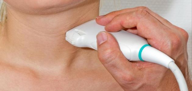 علاج تضخم الغدة الدرقية بدون جراحة