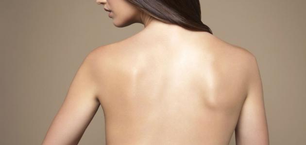 علاج حب الشباب على الظهر بالأعشاب