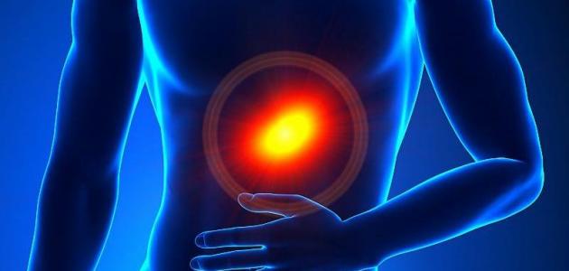 علاج حرقة المعدة علاج حرقة المعدة