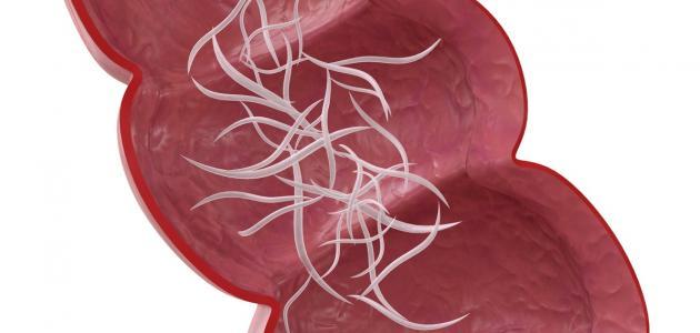 علاج ديدان البطن عند الكبار علاج ديدان البطن عند الكبار