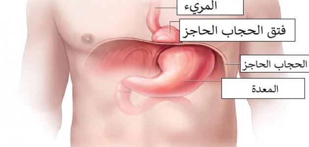 فتق الحجاب الحاجز و أنواعه فتق الحجاب الحاجز و أنواعه