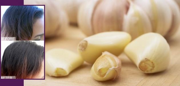 فوائد الثوم لتطويل الشعر فوائد الثوم لتطويل الشعر