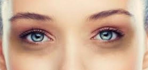 فوائد زيت الخروع للهالات تحت العين