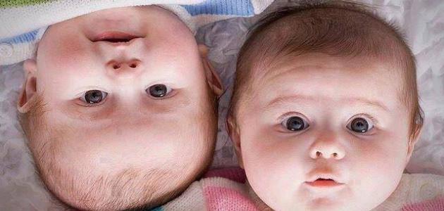 فيتامينات لزيادة الوزن للأطفال فيتامينات لزيادة الوزن للأطفال