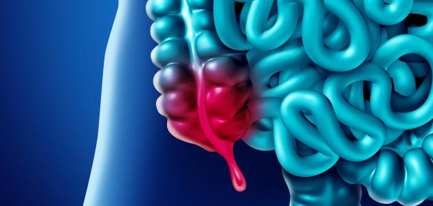 في أي جهة تقع الزائدة الدودية