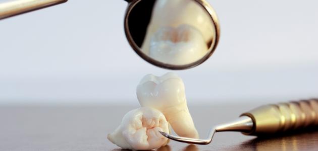 كم عدد ضروس العقل كم عدد ضروس العقل