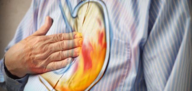 كيفية التخلص من الحموضة كيفية التخلص من الحموضة