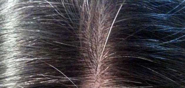 كيفية تقوية فروة الرأس كيفية تقوية فروة الرأس