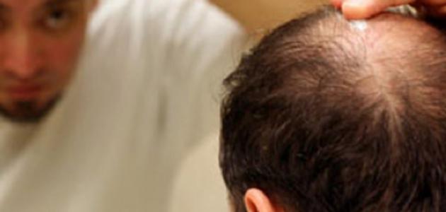 كيفية تنشيط بصيلات الشعر كيفية تنشيط بصيلات الشعر