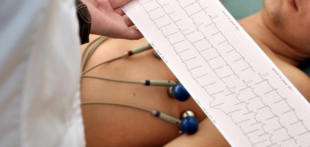 كيفية عمل تخطيط القلب كيفية عمل تخطيط القلب