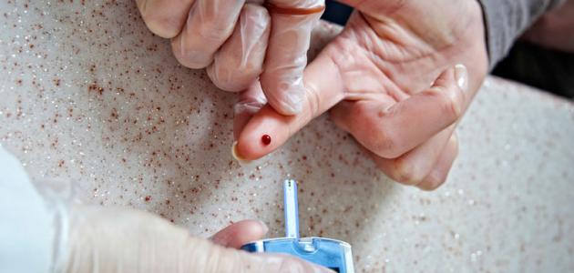 كيفية فحص مرض السكري كيفية فحص مرض السكري