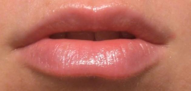 كيف أتخلص من سواد الشفاه