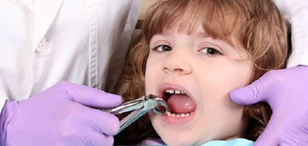 كيف أوقف الدم بعد خلع الضرس كيف أوقف الدم بعد خلع الضرس