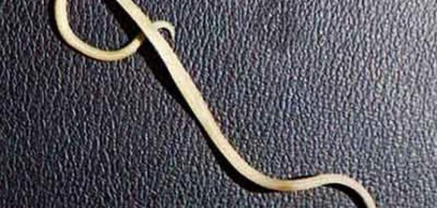 كيف تتخلص من دودة الاسكارس كيف تتخلص من دودة الاسكارس