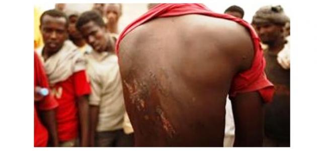 كيف عالج الاسلام قضية الرق كيف عالج الاسلام قضية الرق