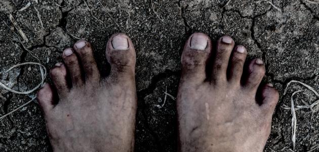 لماذا سميت غزوة ذات الرقاع لماذا سميت غزوة ذات الرقاع