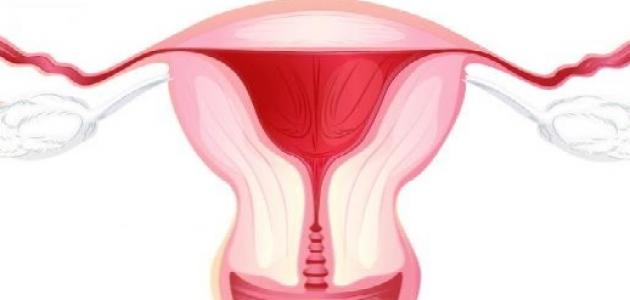 ما أسباب التهابات المهبل ما أسباب التهابات المهبل