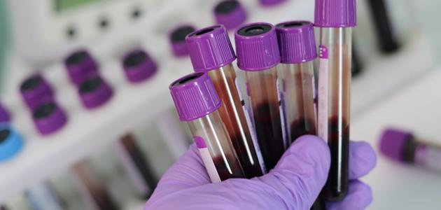 ما أسباب التهاب الدم ما أسباب التهاب الدم